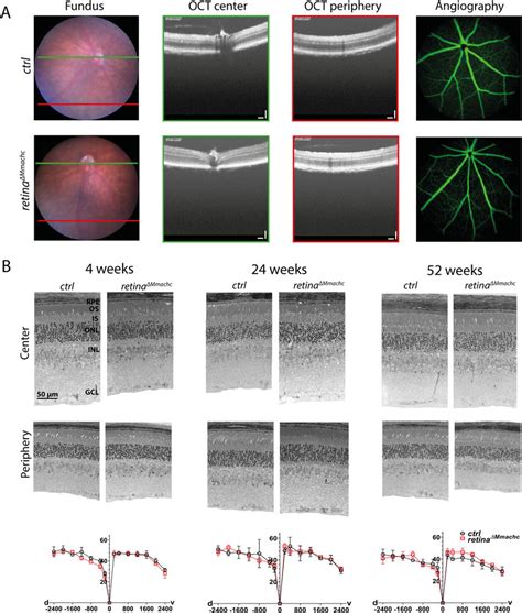 refractometer for mice|mouse retina optics.